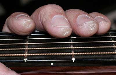 Calluses and pain from the guitar
